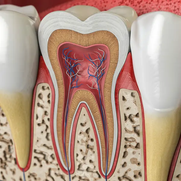 dental implants replacement in joplin